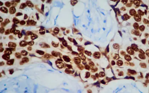 혈뇨가 나오는 이유 13