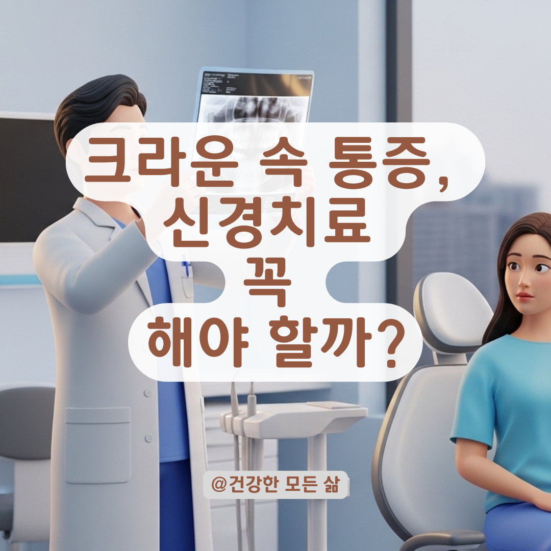 크라운 속 재발한 충치, 신경치료 여부 결정하는 결정적 단계!