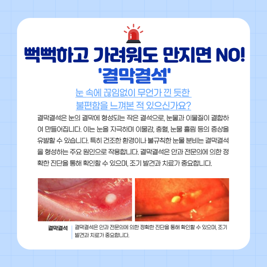 결막결석