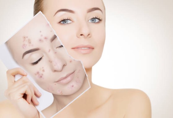 피부 트러블 진정 시키는 방법