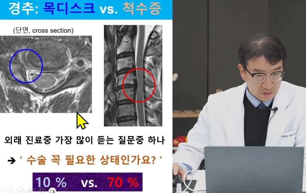 명의-목중풍-강경중-교수