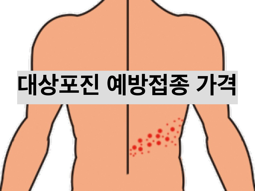 대상포진 예방접종 가격