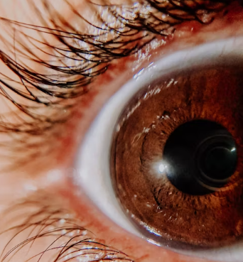 녹내장 치료법 진단 기준 합병증