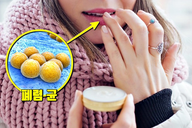 립밤 폐렴 원인, 팁줌