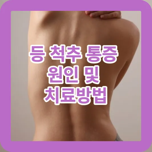 등 척추 통증 원인 및 치료방법