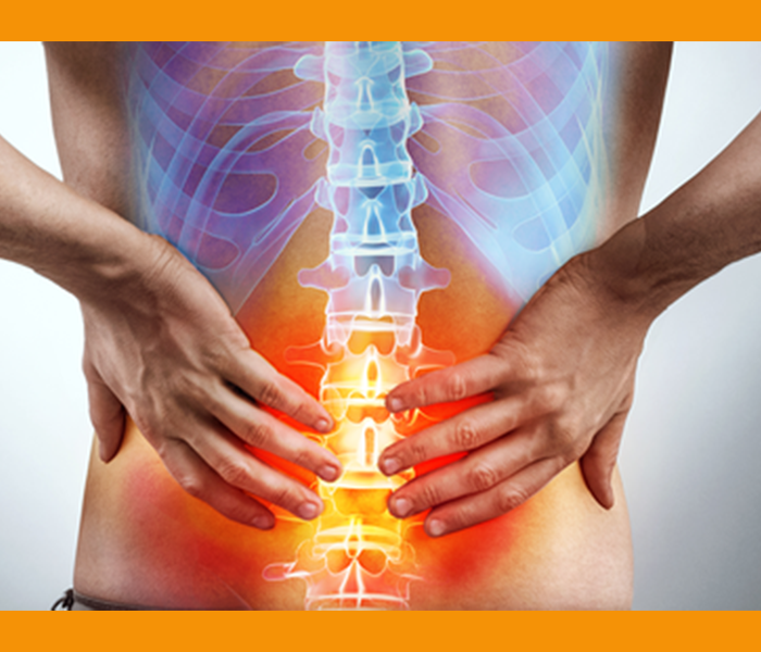 오른쪽 옆구리 통증 원인 - 허리디스크