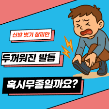 무좀 원인과 증상