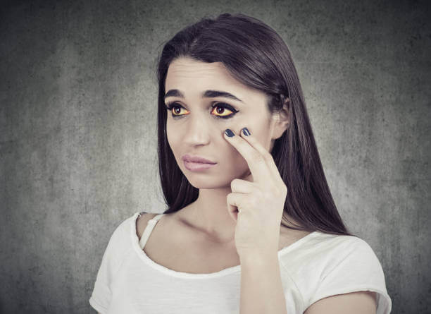 다크서클을 개선하는 눈가 스트레칭 방법