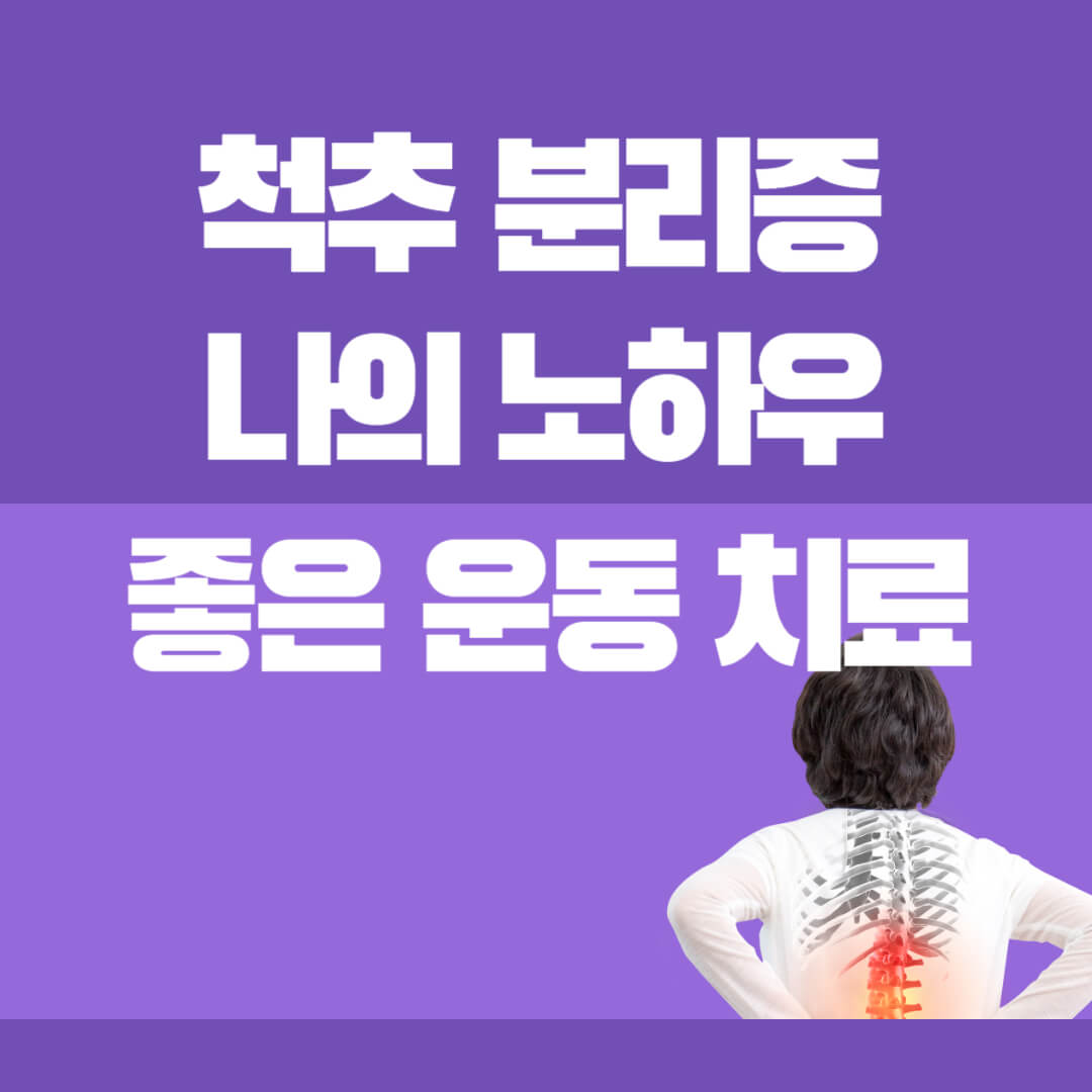 척추분리증이란?