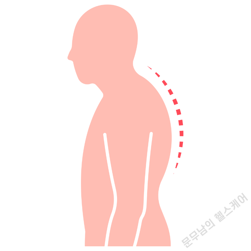 굽은등 라운드 숄더 스트레칭 4가지 방법