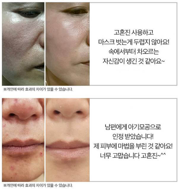 고혼진 화장품 가격, 최저가 전략