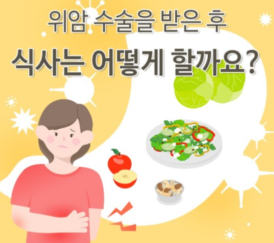 위암 수술 후 식사 이미지