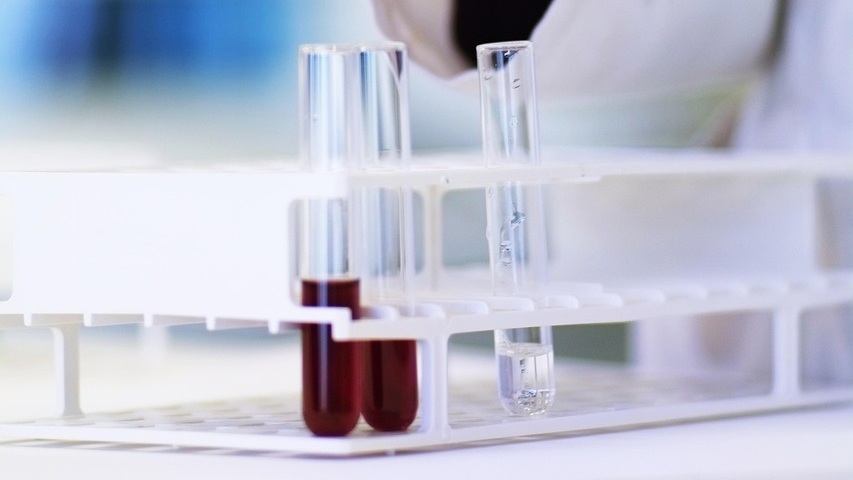 혈액 시험관
