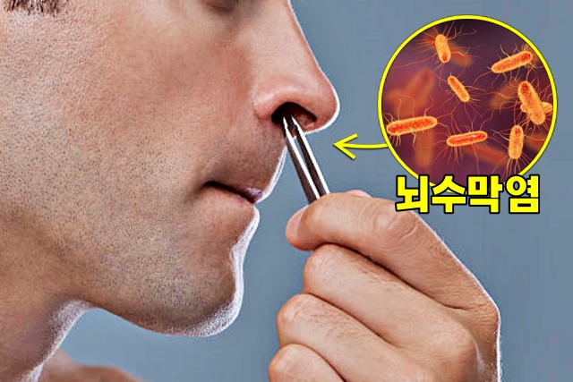 콧털 뽑기, 코가 붓는 이유, 코 붓기 원인, 건강 팁줌 매일꿀정보