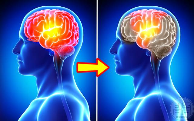 뇌에 피가 부족할때 증상 피가부족한증상 뇌혈류장애