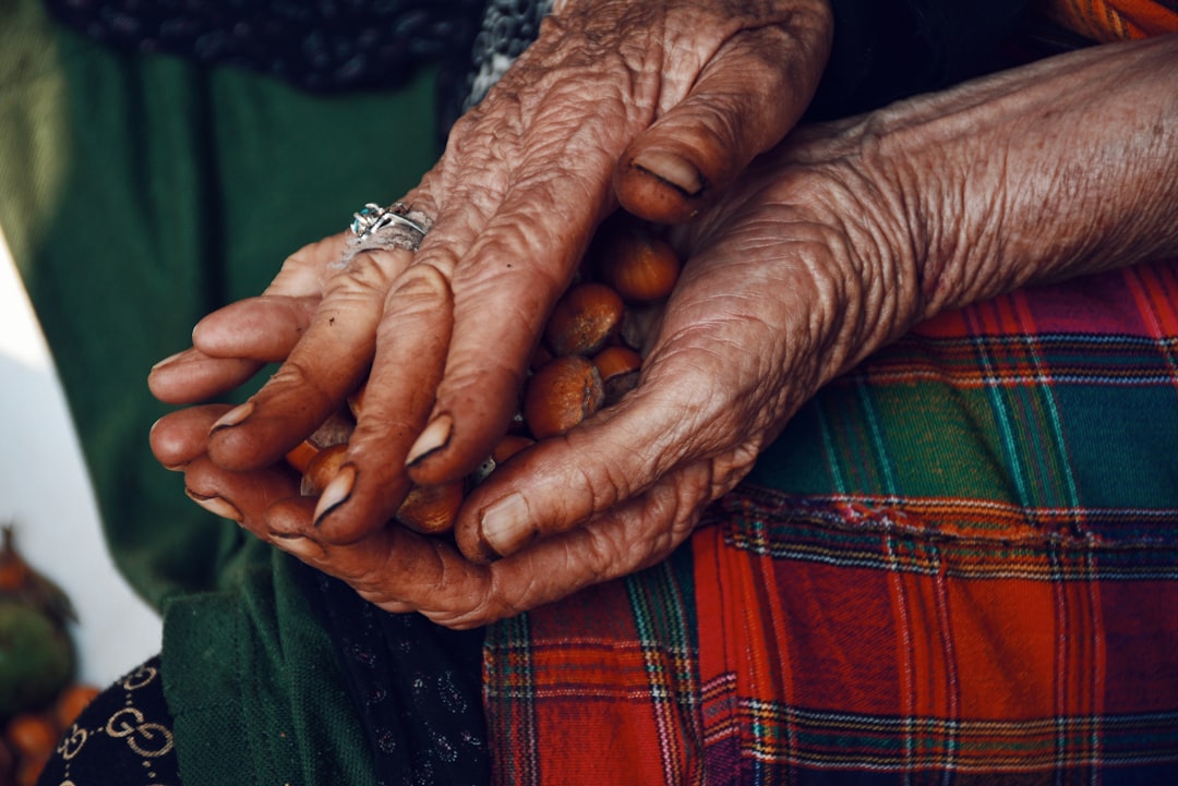 Arthritis.
