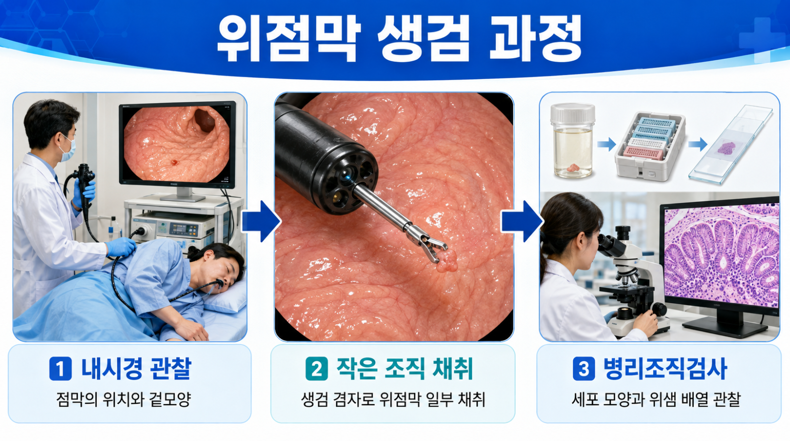 내시경 관찰부터 위점막 조직 채취와 병리조직검사까지 이어지는 위점막 생검 과정