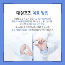 대상포진 초기증상