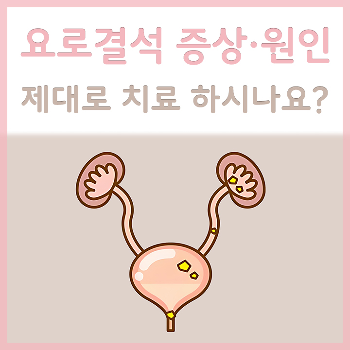 요로결석의-모습