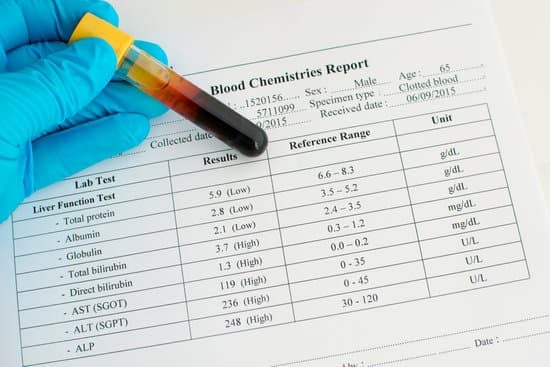 간기능 검사 결과