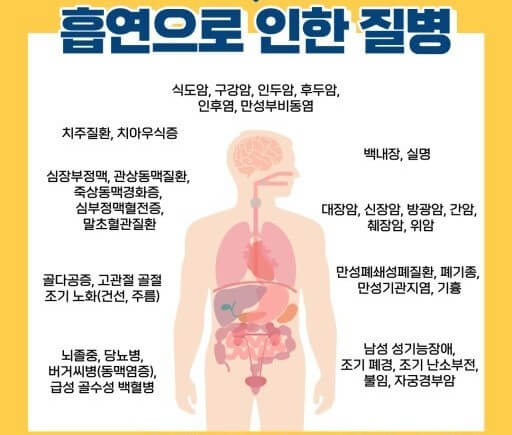 흡연으로 인한 질병들
