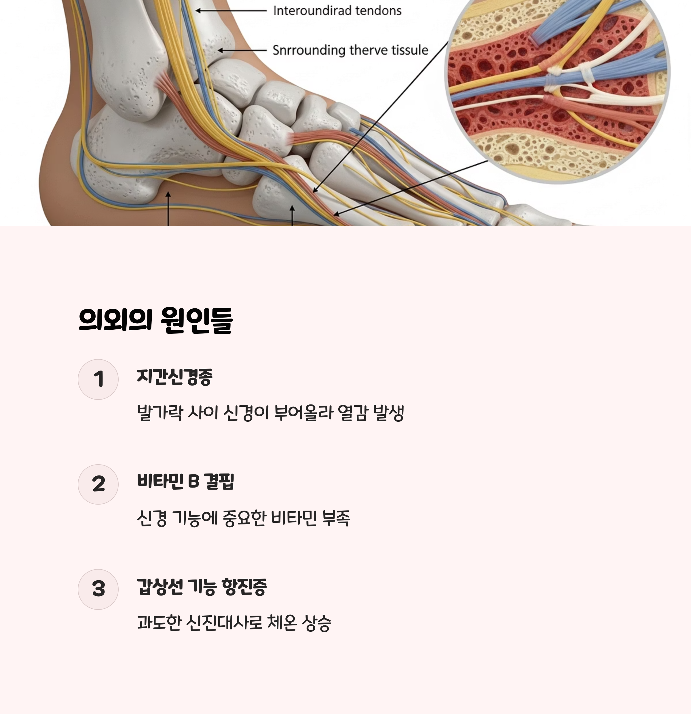 1.5 그 외 원인들: 의외의 복병들! 🧐