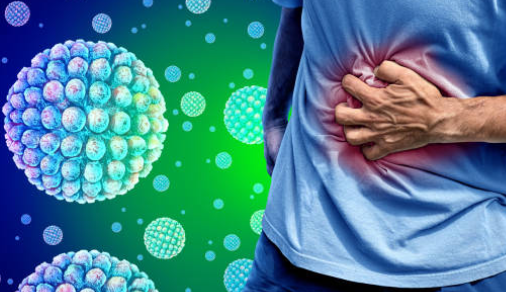 노로바이러스 증상