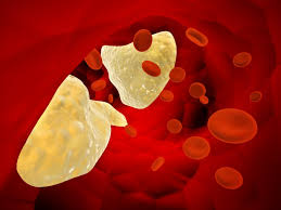 콜레스테롤 낮추는 방법 10가지