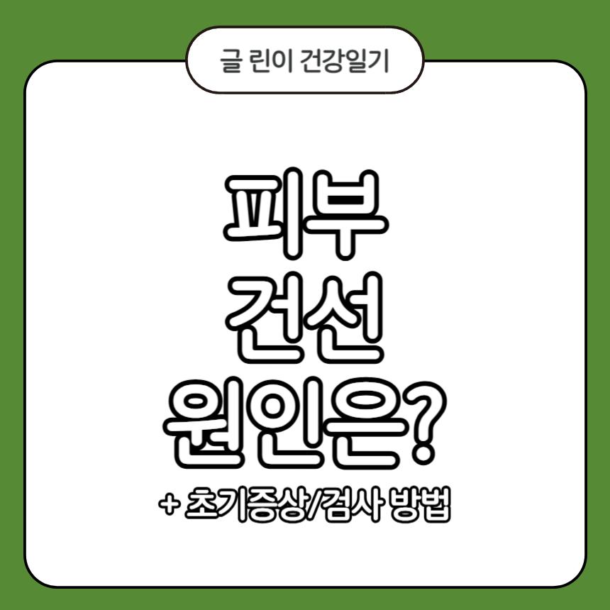 피부 건선 원인