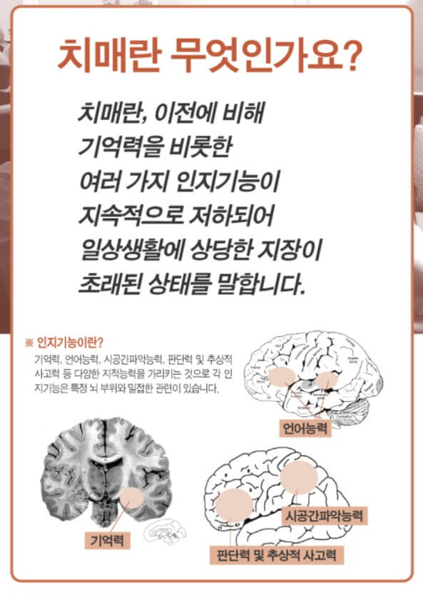 치매로 인한 일상의 어려움