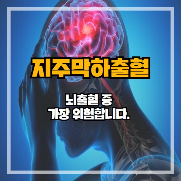 뇌출혈 중 가장 위험한 지주막하출혈, 놓치면 치명적입니다