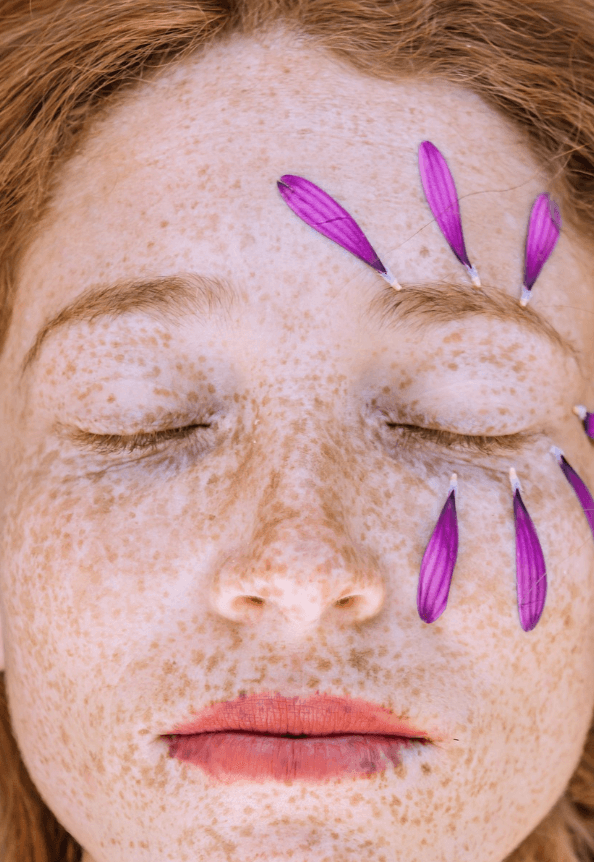 점이 생기는 이유로 관련된 사진 - 7