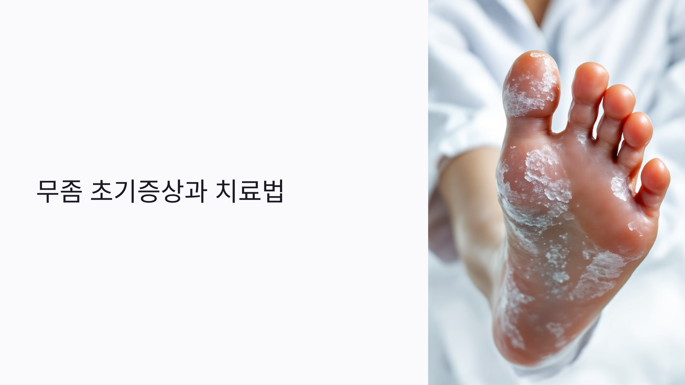 무좀 초기증상, 자가진단으로 확인하는 방법