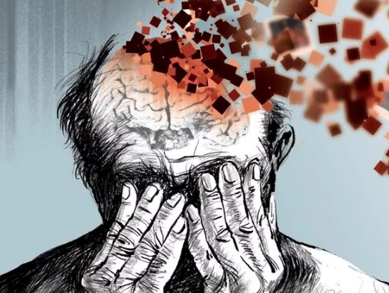 치매 검사 방법