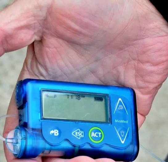 인슐린 주사 종류 펌프 사진 입니다.