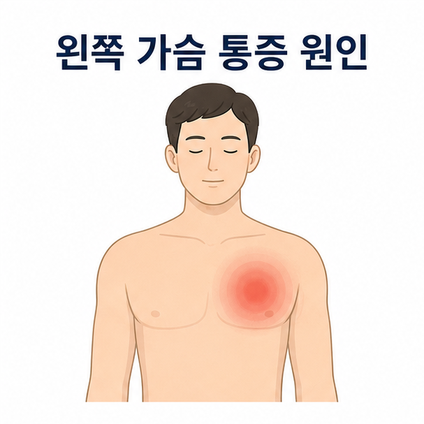 사람 상체의 왼쪽 가슴 부위를 표시해 왼쪽 가슴 통증을 표현한 대표 이미지