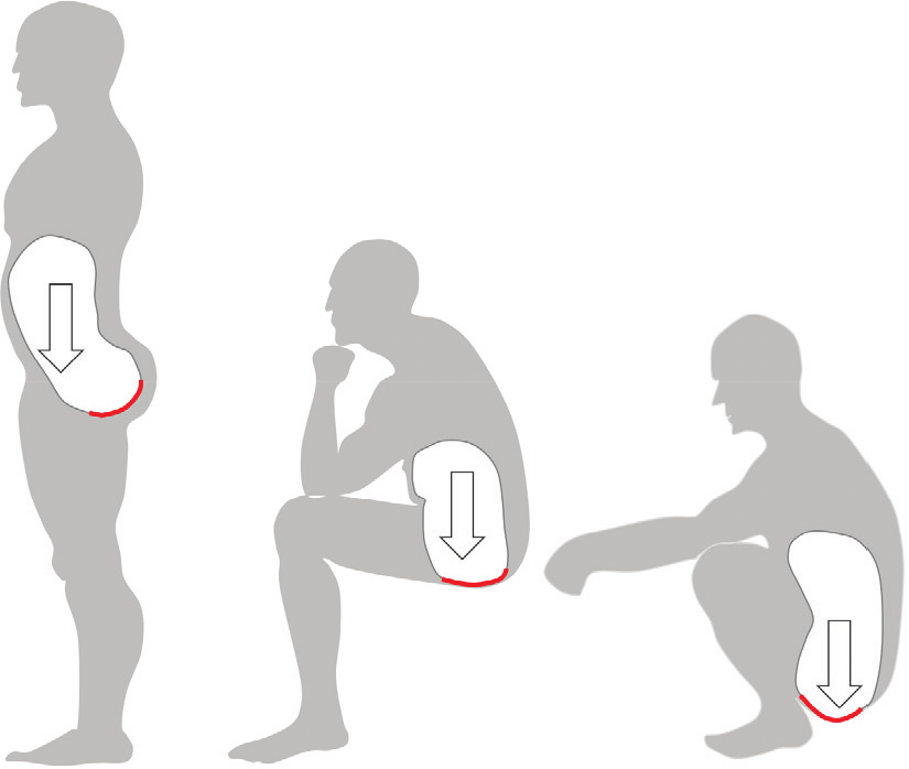 항문 괄약근 강화 케겔운동 방법