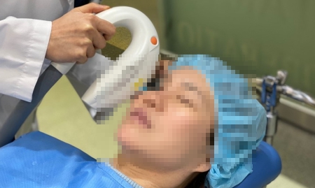 IPL 시술 사례 사진입니다.