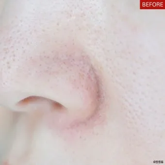 남자 얼굴 피지 제거 화장품 꿀템_22