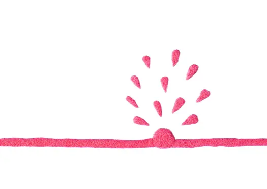 뇌경색 초기증상, 원인 및 치료 방법