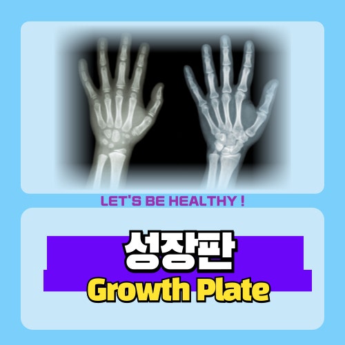 우리 아이 키 성장, 지금 확인하세요 – 성장판 검사 시기·비용 완전 가이드 관련 사진