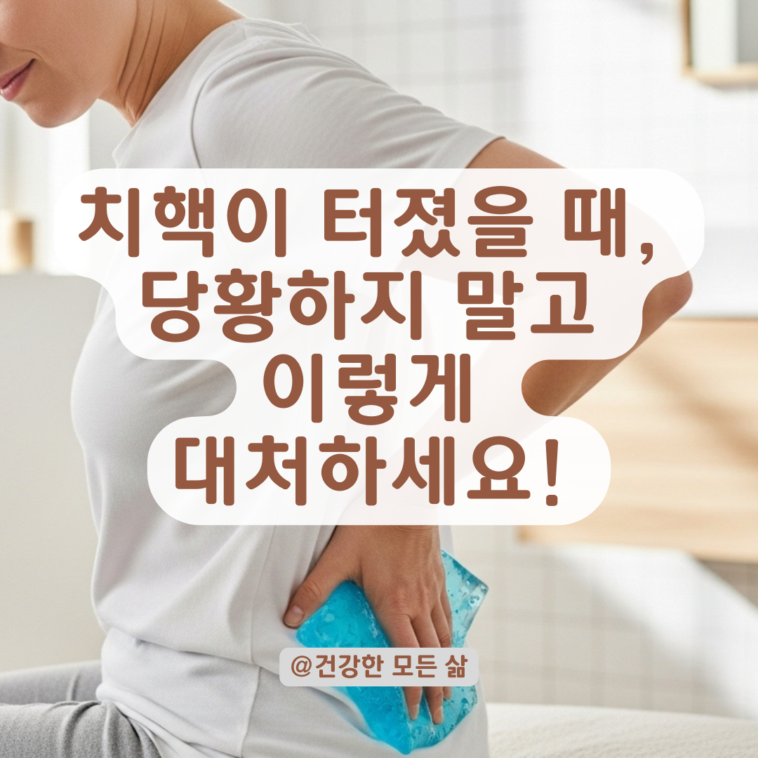 오래된 치핵, 무리한 배변 후 부풀고 터질 때 알아야 할 응급 관리법