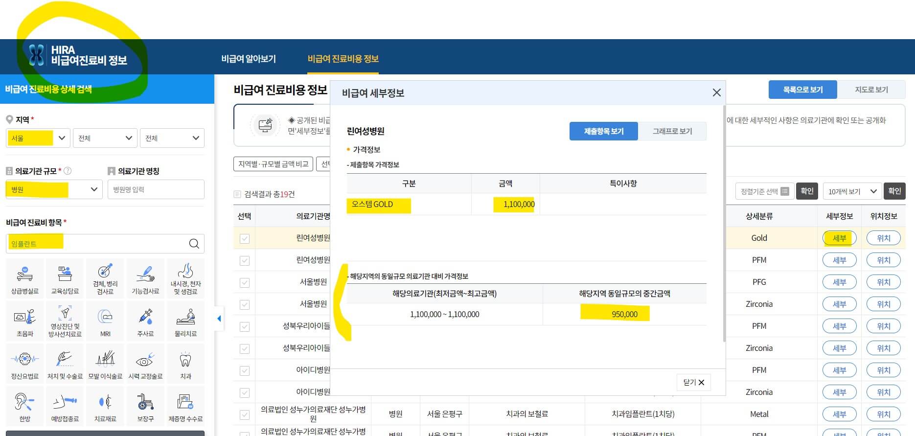 임플란트 본인부담금