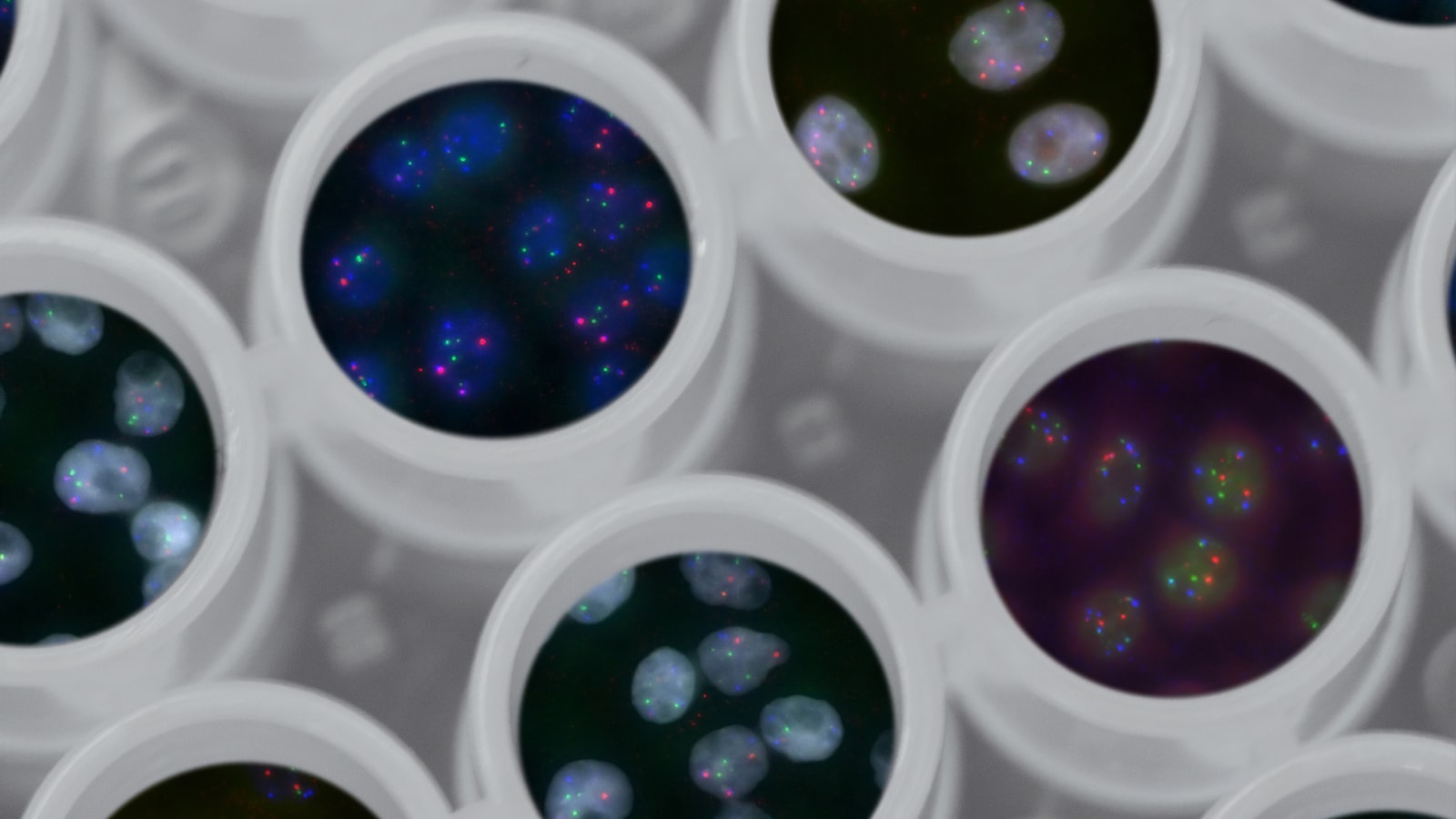 candidiasis and aspergillosis 2