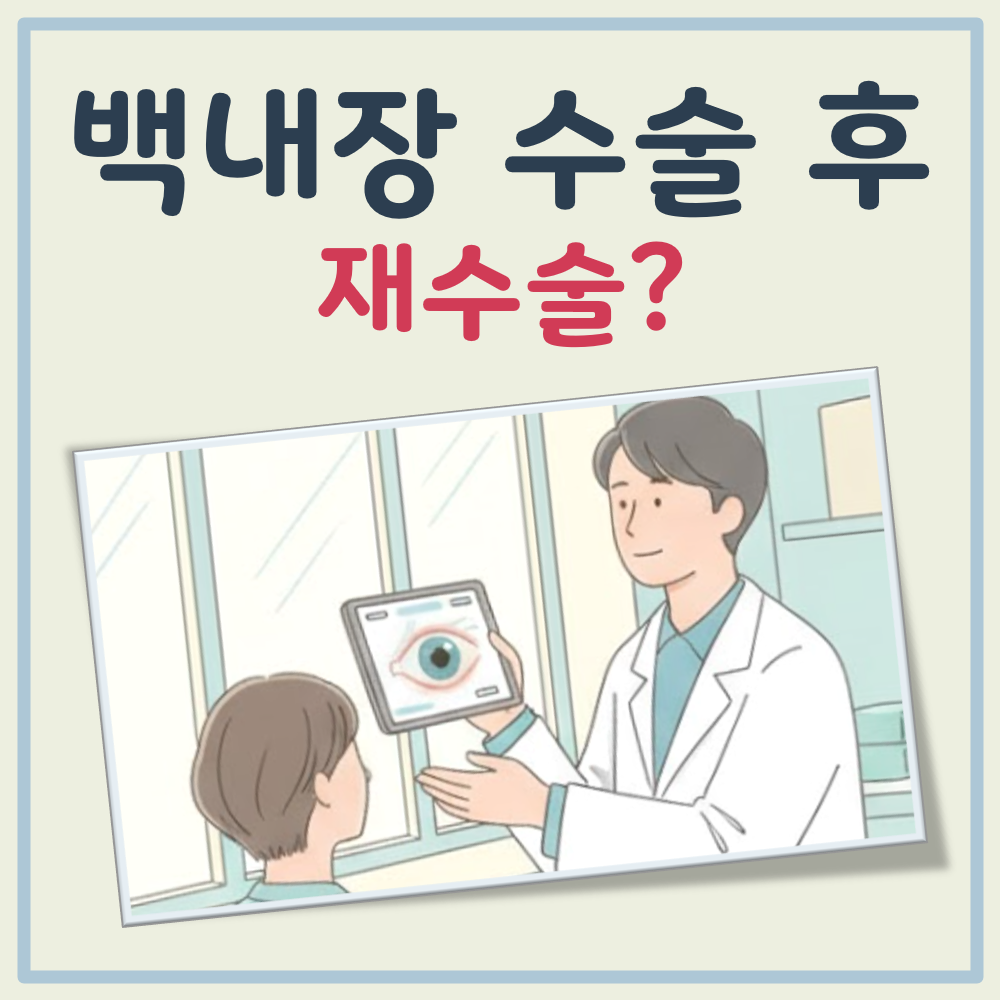 백내장 수술후 재수술 대표 이미지