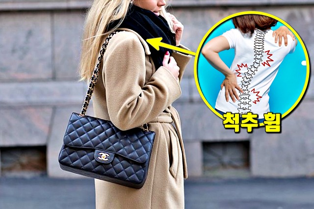 한쪽으로 샤넬백 메기 척추 측만증 원인, 팁줌