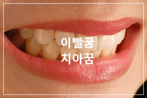 치아