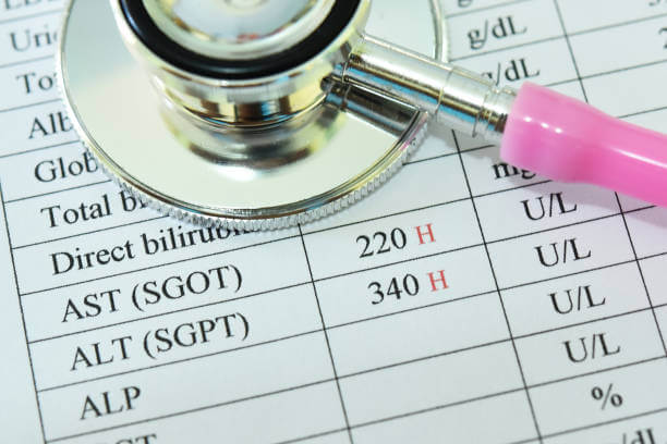 간수치 낮추는법 및 낮춰주는 음식. 간수치가 높으면 다양한 증상들이 나타나는데요. 어떤 증상과 정상 수치는 무엇인지 참고하시기 바랍니다.