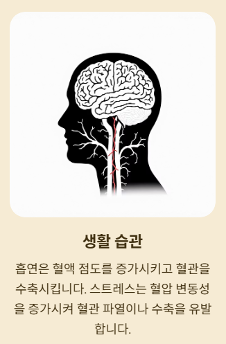 뇌경색의 원인