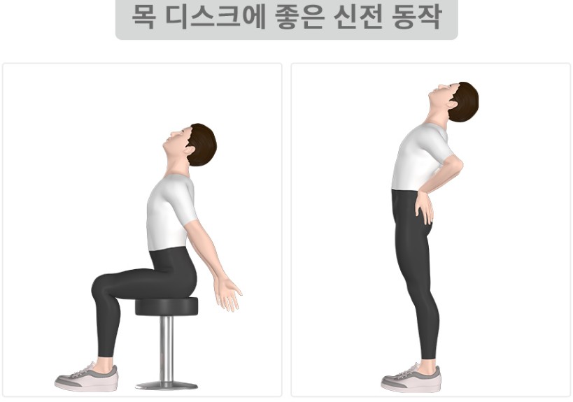 뻐근한 목 통증, 거북목 일자목 증상일까? 목디스크에 좋은 신전동작, 나쁜자세 운동